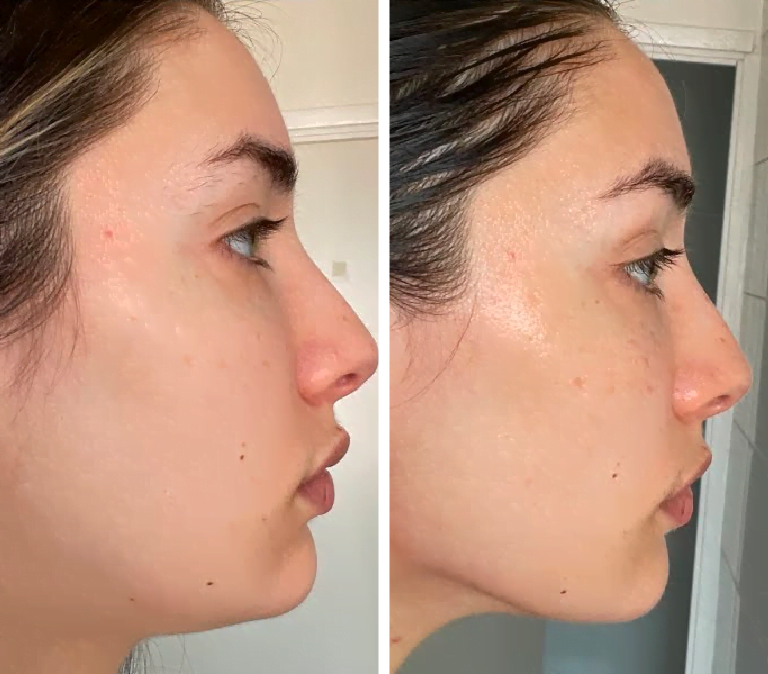 Jade Roller and Gua Sha Stone Set