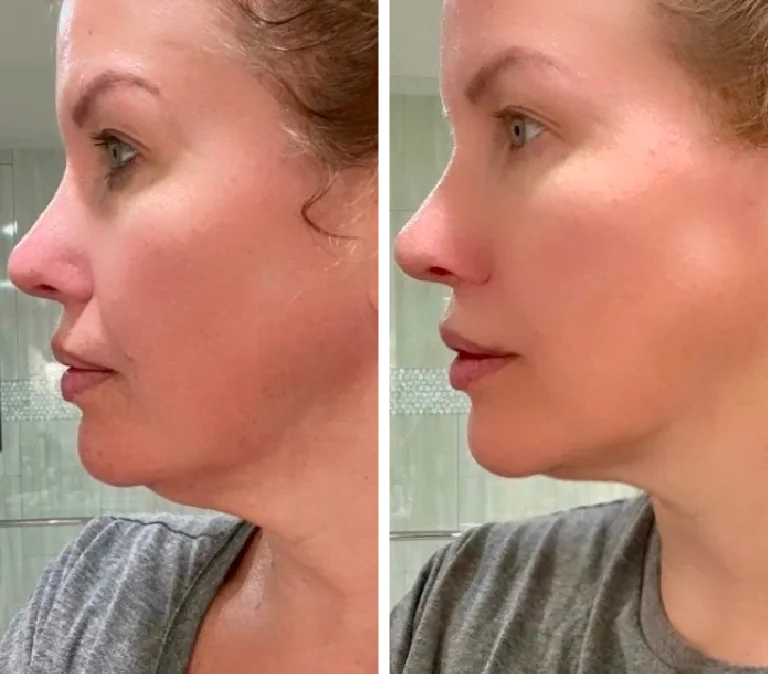 Jade Roller and Gua Sha Stone Set